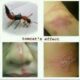 Foto serangga Tomcat dan dampak apabila racunnya terkena tubuh (sumber: istimewa)