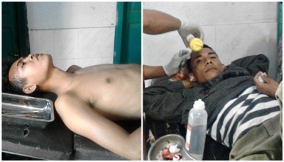 Dua Korban pelemparan oleh simpatisan salah satu paslon di Kecamatan Bolo. Foto: Ady