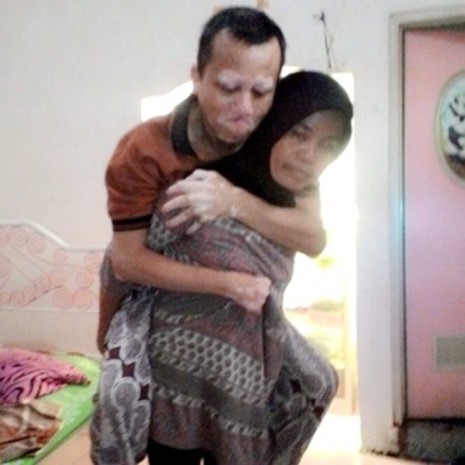 Suami Lumpuh, Sri Jadi Tulang Punggung Keluarga