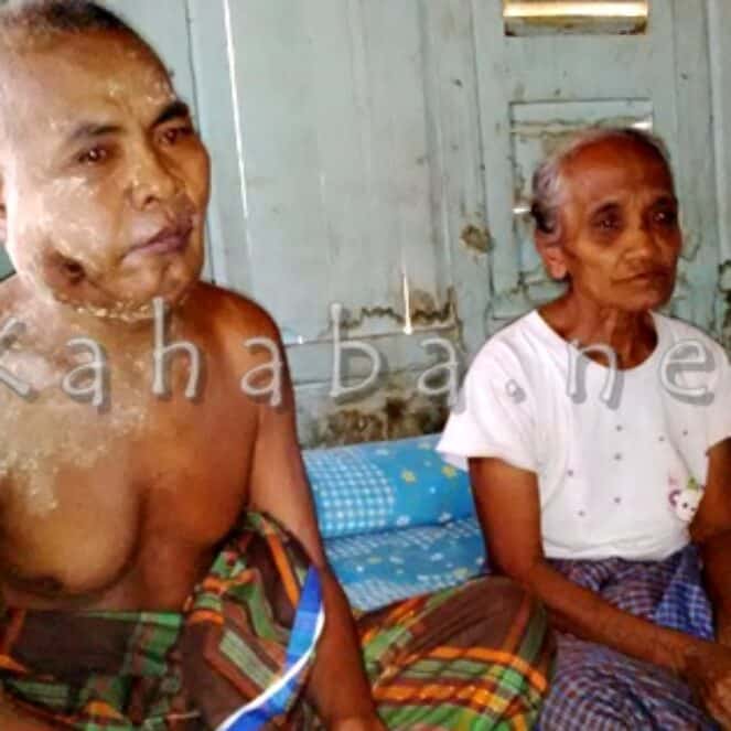 Pemerintah Dituding Apatis Terhadap Kondisi Penderita Kanker