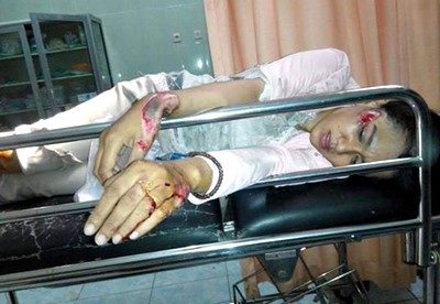 Wartawati Bima TV, Tari dengan luka ditubuh saat di RSUD Bima. Foto: Akhyar M Nur (Facebook)