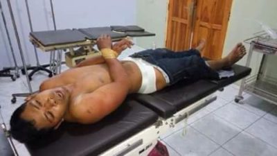 Pelaku mutilasi saat terbaring di RSUD Bima usai dilumpuhkan aparat. Foto: Deno