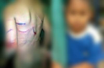 LPA Tangani Bocah Korban Aniaya, Besok Bapaknya Dilapor Polisi - Kabar Harian Bima