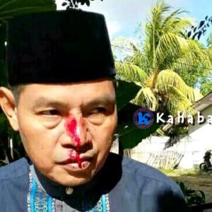 Kades Kananga Dianiaya Oknum Anggota TNI - Kabar Harian Bima