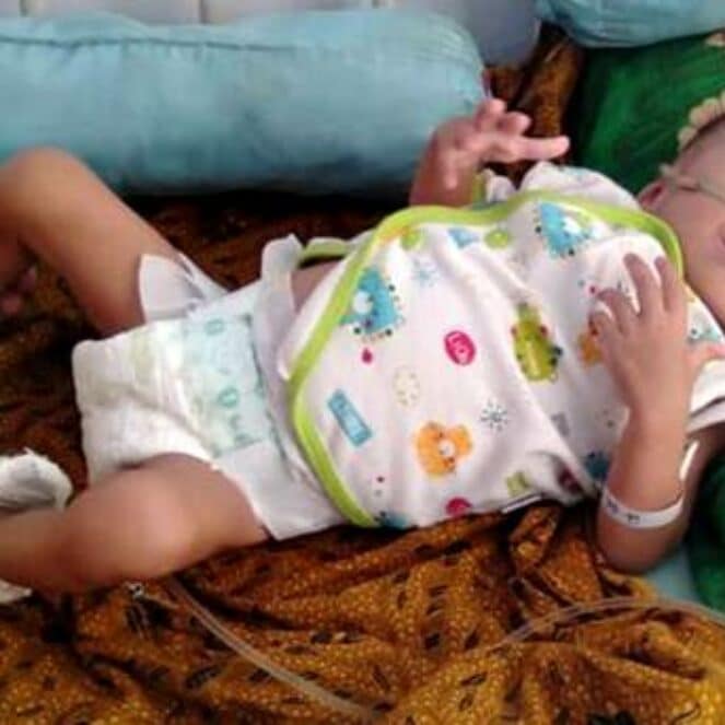 Derita Paru-Paru Bocor, Bayi Malang Ini Butuh Bantuan