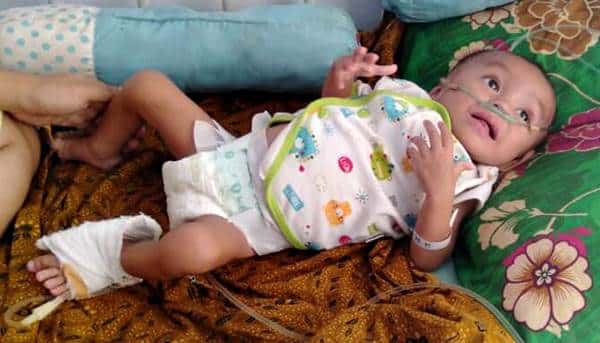 Derita Paru-Paru Bocor, Bayi Malang Ini Butuh Bantuan - Kabar Harian Bima