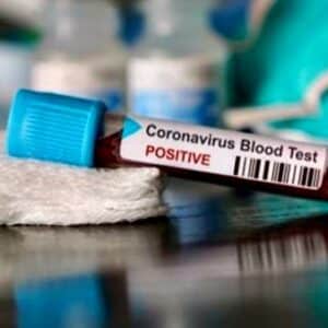 Seorang Warga Kota Bima Terkonfirmasi Lagi Positif Virus Corona, Kabupaten Bima 1 Orang