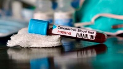 Seorang Warga Kota Bima Terkonfirmasi Lagi Positif Virus Corona, Kabupaten Bima 1 Orang - Kabar Harian Bima